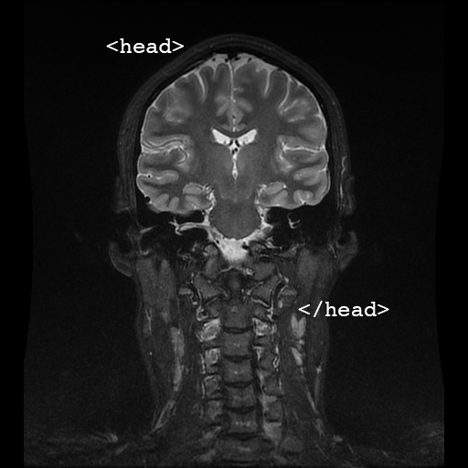 High-end medical tech